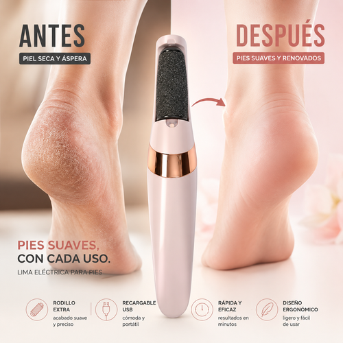 Removedor De Callos Profesional
